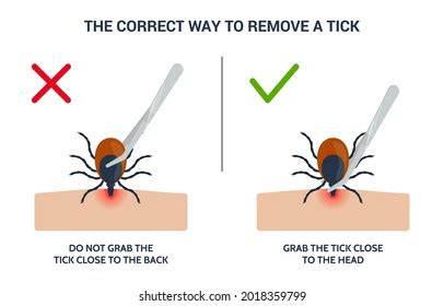 Correct Way Remove Tick Insect Correctly Stock Vector (Royalty Free ...