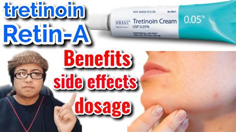 Tretinoin cream review|Retin A for Skin|beginner guide|dosage|side effect hindi/urdu - YouTube