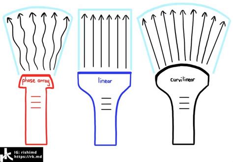 Ultrasound - Piezoelectric Effect, Frequency, and Probe Types - RK.md