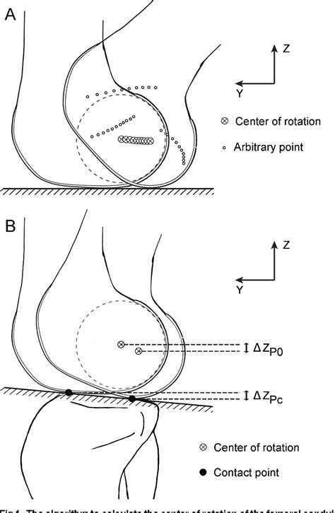 Figure 1 from Identifying the Functional Flexion-extension Axis of the ...