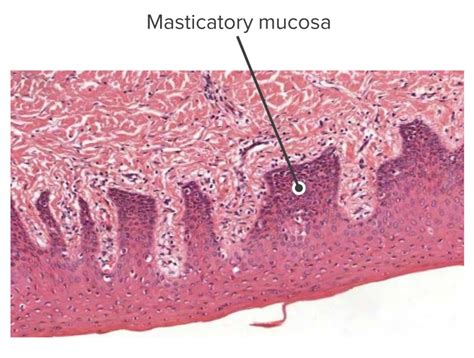 Hard Palate Histology