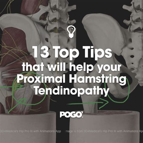 13 Top Tips that will help your Proximal Hamstring Tendinopathy | POGO Physio Gold Coast