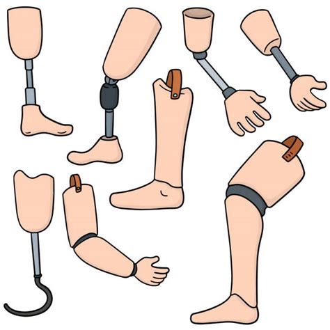 Prosthetic Leg Illustrations, Royalty-Free Vector Graphics & Clip Art ...