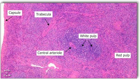 spleen histology - Google Search | Histología, Anatomía, Biología