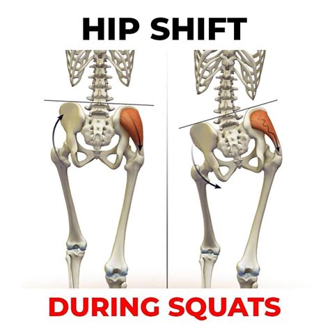 James Lu - RMT 🇨🇦 TO on Instagram: “🚨 HOW TO CORRECT HIP SHIFT DURING ...