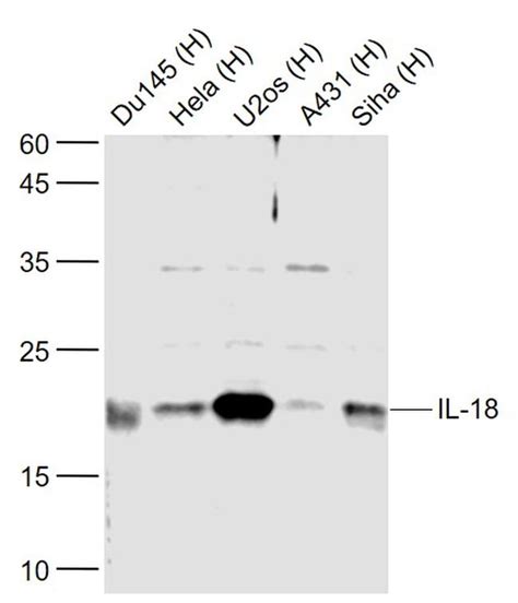 IL-18 Polyclonal Antibody (BS-4986R)