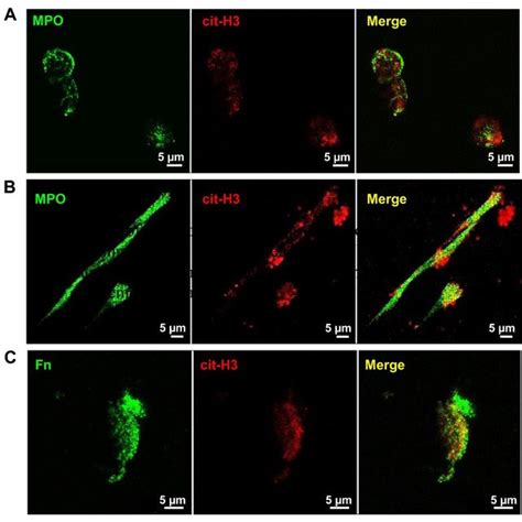 Neutrophil extracellular traps (NETs) formation detected in real time... | Download Scientific ...