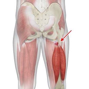 Hamstring Tendon Anatomy