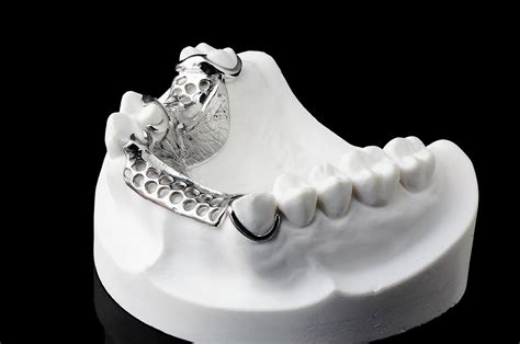 Chrome Cobalt | Hdmdental.co.uk