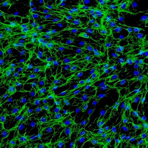 Human Small Intestine Fibroblasts – Cells Online