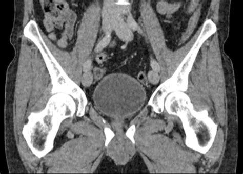 Pelvic CT - Insight Medical Imaging