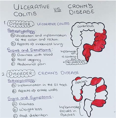 Ulcerative Colitis Vs Crohn's Disease - MEDizzy