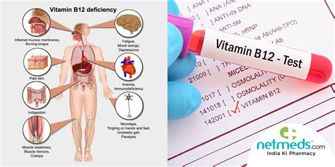 Vitamin B12 Deficiency Test: What Is it And What To Expect?