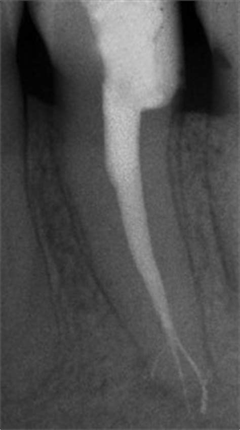 4: Biologic Aspects | Pocket Dentistry