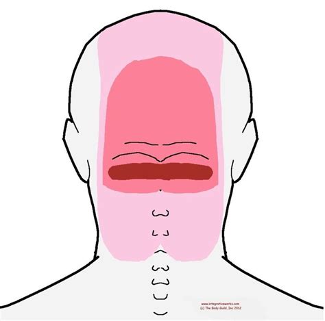 Understanding Trigger Points – Headache at the back of your head | Trigger points, Occipital ...