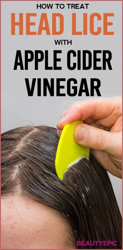 How to Treat Head Lice with Apple Cider Vinegar? | Apple cider vinegar for hair, Remedies ...