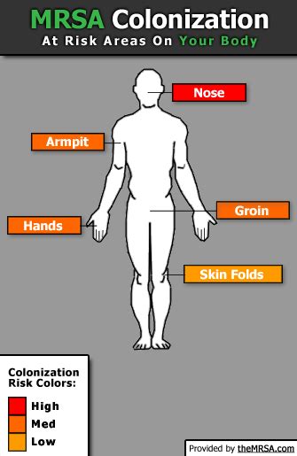 MRSA Colonization | Mrsa, Infection control nursing, Sick remedies