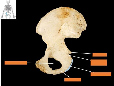 Hip bone, medial view, right ischium Diagram | Quizlet