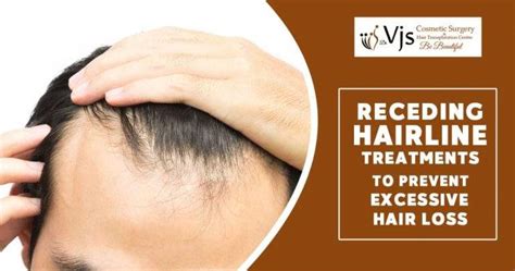 3 Best Hairline Treatments to Prevent Excessive Hair Loss - vjclinics.com