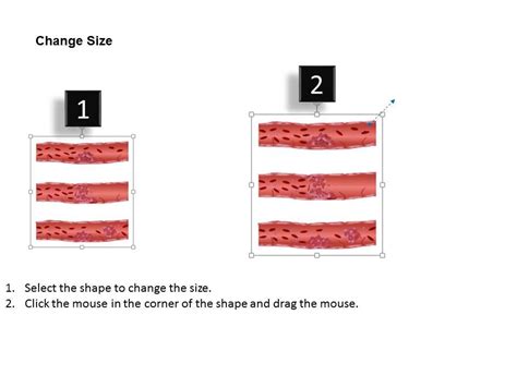 0814 Types Of Thrombosis Medical Images For Powerpoint | Presentation ...