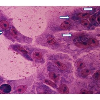 Microscopic observation of intracellular parasite at 24 hours and 48 ...