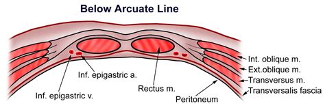 Arcuate Line Of Rectus Sheath