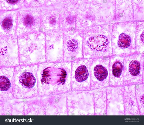 Mitosis In Onion Cells Of The Root Meristem. In The Central Rowof Cells, There Is A Prophase ...