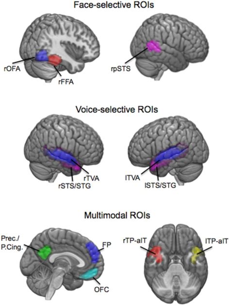 Fusiform Face Area Diagram