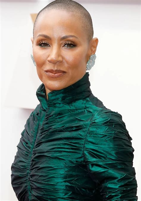 Does Jada Pinkett Smith have alopecia? | The US Sun