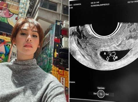 Empress Schuck Shares Her Heartbreak over Miscarriage on Instagram - Rapid News PH