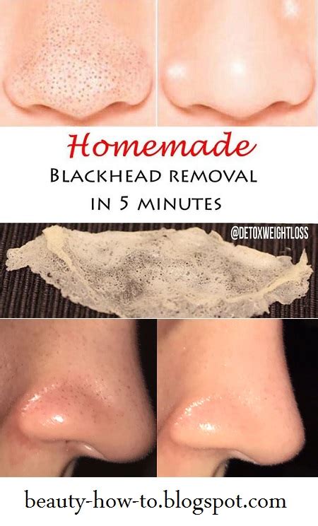 homemade blackhead removal in just 5 minutes - How To Beauty