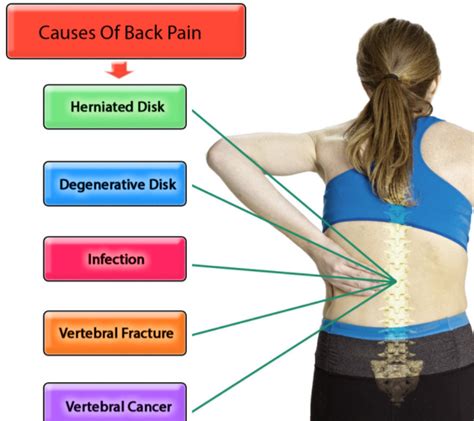 Causes of Back Pain: What Causes Back Pain? - Health Normal