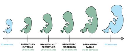 Recién Nacido Prematuro - Mind Map