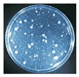 Bacterial Identification, Microbial Limit Test, Standard Plate Count ...