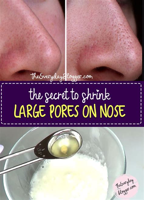 How To Shrink Large Pores On Nose - The Everyday Blogger