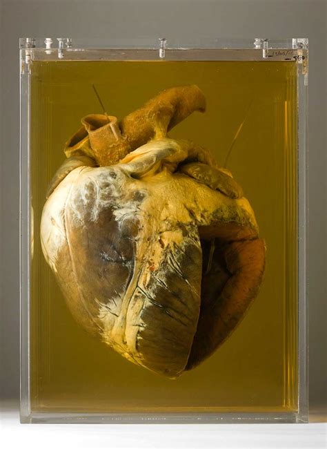 Parts of Phar Lap's heart | National Museum of Australia