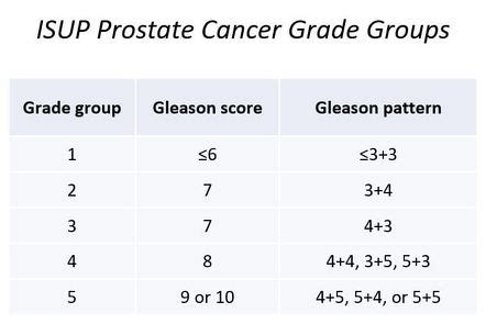 Prostate cancer (staging) | Radiology Reference Article | Radiopaedia.org