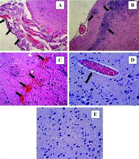 The histopathological images of Group 1 in the pia mater (A, B, ×10; C ...