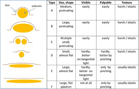 Morphological Types