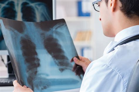 Pulmonology in Kansas City, MO | Ascentist Healthcare