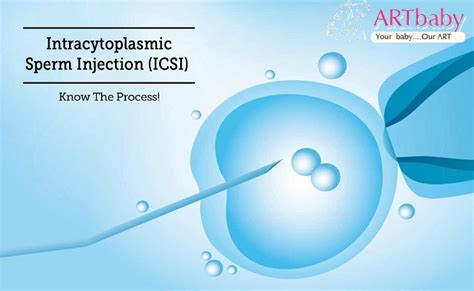 Chances of successful pregnancy with ICSI in childless couples ART baby Egg Donors