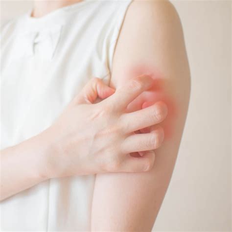 Allergic Rash Treatment In Singapore | Ang Skin & Hair Clinic