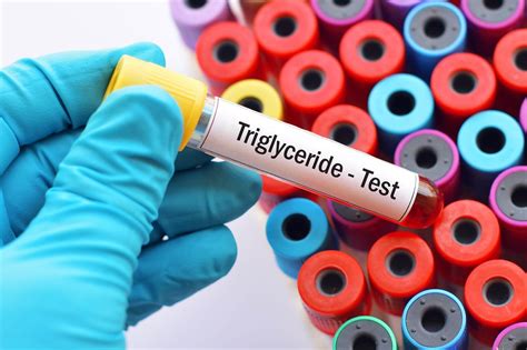 Suboptimal Triglyceride Levels Common Among US Adults - The Cardiology ...