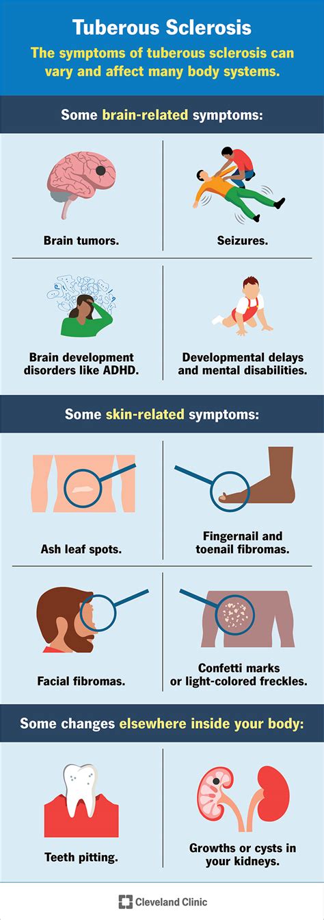 Tuberous Sclerosis: What It Is, Symptoms & Treatment