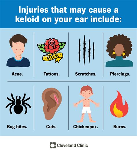 Keloid on Ear: What It Is, Piercing, Removal, Scar, Behind Ear