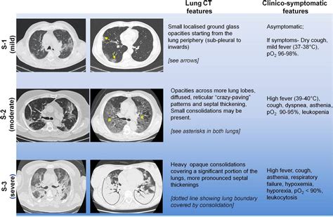 A Quantitative Lung Computed Tomography Image Feature for Multi-Center ...