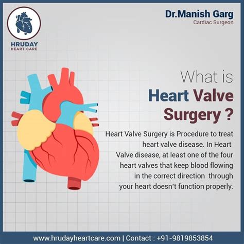 WHAT IS HEART VALVE SURGERY?. Heart Valve Surgery is a surgical… | by ...