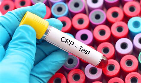 C-Reactive Protein Test - Private Blood Tests London