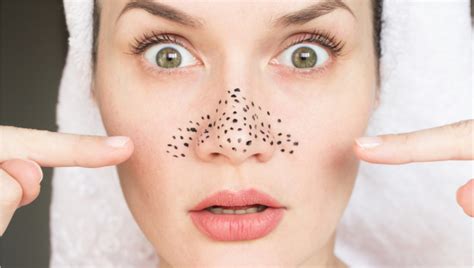 Beauty tips: Shrink large pores naturally at home with these hacks ...