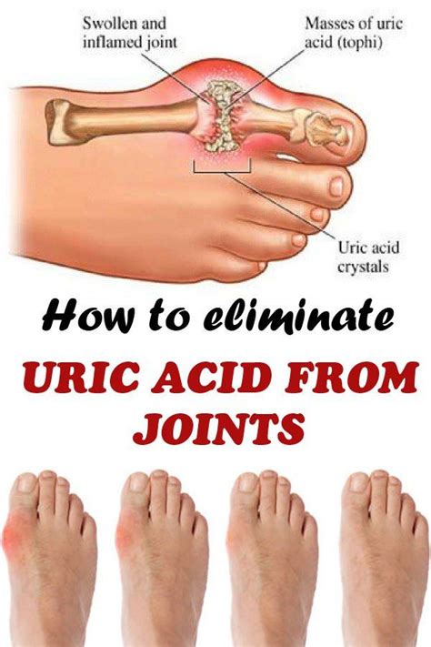 How to eliminate uric acid from joints: Juice together: 1 cucumber 2 pieces ce…